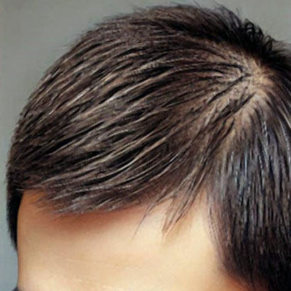 ヘアマックス使用後